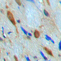 19 - Anti-MNK1 Antibody AP60484