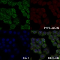 3 - Anti-MRPL35 Antibody AP60485