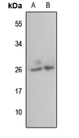 1 - Anti-MRPL35 Antibody AP60485