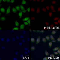 3 - Anti-MTA1 Antibody AP60489
