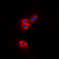 3 - Anti-Merlin Antibody AP60490