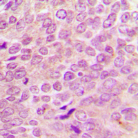 19 - Anti-Merlin Antibody AP60490