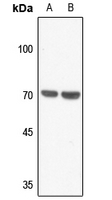 1 - Anti-Merlin Antibody AP60490