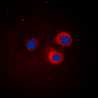 3 - Anti-IKB epsilon Antibody AP60492