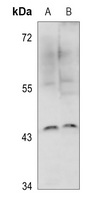 1 - Anti-IKB epsilon Antibody AP60492