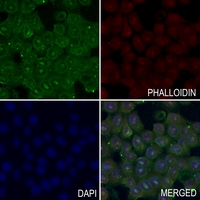 3 - Anti-TOPK (Phospho-T9) Antibody AP60497