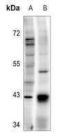 1 - Anti-TOPK (Phospho-T9) Antibody AP60497