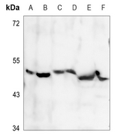 1 - Anti-PDK2 Antibody AP60498