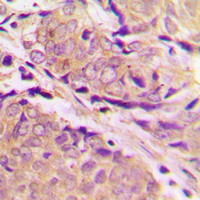 19 - Anti-PFKM Antibody AP60499