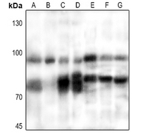 1 - Anti-PFKM Antibody AP60499