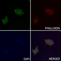 3 - Anti-PPT Antibody AP60500
