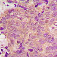 19 - Anti-PPT Antibody AP60500