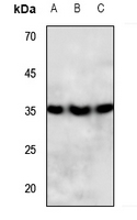 1 - Anti-PPT Antibody AP60500