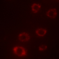 3 - Anti-PTX3 Antibody AP60502