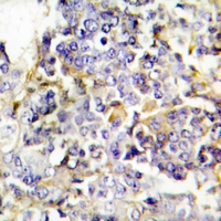 19 - Anti-PTX3 Antibody AP60502