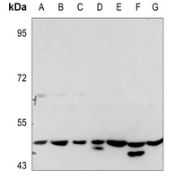 1 - Anti-PTX3 Antibody AP60502