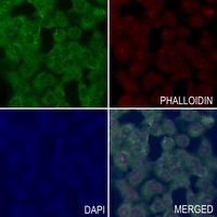 3 - Anti-RAB6A Antibody AP60503
