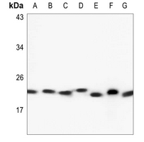 1 - Anti-RAB6A Antibody AP60503
