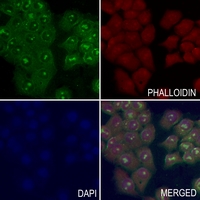 3 - Anti-RAB8B Antibody AP60504