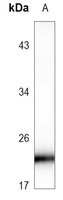 1 - Anti-RAB8B Antibody AP60504