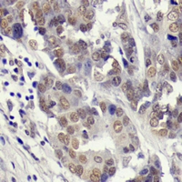 19 - Anti-YAP1 (Phospho-S127) Antibody AP60506