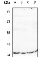 1 - Anti-RIMKLB Antibody AP60507