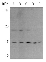 1 - Anti-RPS23 Antibody AP60508