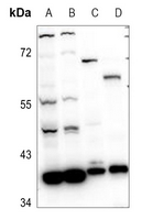 1 - Anti-RRM2B Antibody AP60509