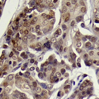 19 - Anti-SGK1 (Phospho-S78) Antibody AP60510