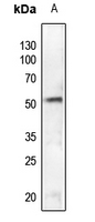 1 - Anti-SGK1 (Phospho-S78) Antibody AP60510