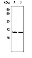 1 - Anti-CAT4 Antibody AP60512