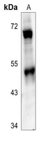 1 - Anti-SMYD2 Antibody AP60513