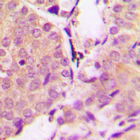 19 - Anti-Alpha-synuclein (Phospho-Y133) Antibody AP60514