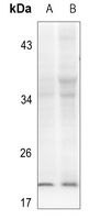 1 - Anti-Alpha-synuclein (Phospho-Y133) Antibody AP60514