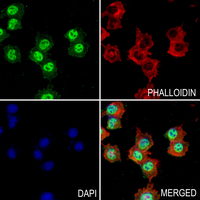 3 - Anti-SP1 (Phospho-T739) Antibody AP60515