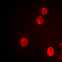 3 - Anti-SPIN1 Antibody AP60517