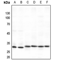 1 - Anti-SPIN1 Antibody AP60517