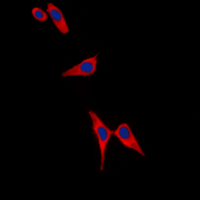 3 - Anti-Tyrosine Hydroxylase (Phospho-S19) Antibody AP60518