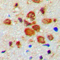 19 - Anti-Tyrosine Hydroxylase (Phospho-S19) Antibody AP60518
