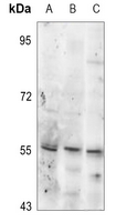 1 - Anti-Tyrosine Hydroxylase (Phospho-S19) Antibody AP60518