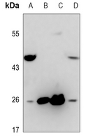 1 - Anti-CD153 Antibody AP60519