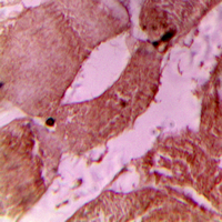 19 - Anti-cTnI (Phospho-S22/S23) Antibody AP60520