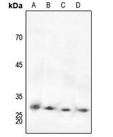1 - Anti-cTnI (Phospho-S22/S23) Antibody AP60520