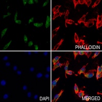 3 - Anti-UCP3 Antibody AP60522