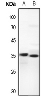 1 - Anti-UCP3 Antibody AP60522