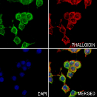 3 - Anti-ULK3 Antibody AP60523