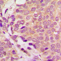19 - Anti-ULK3 Antibody AP60523