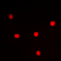 3 - Anti-UTP14A Antibody AP60524