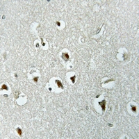 19 - Anti-UTP14A Antibody AP60524