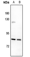 1 - Anti-UTP14A Antibody AP60524